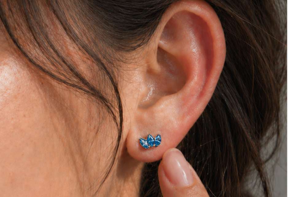 Lobulares recto - Up Lobulo